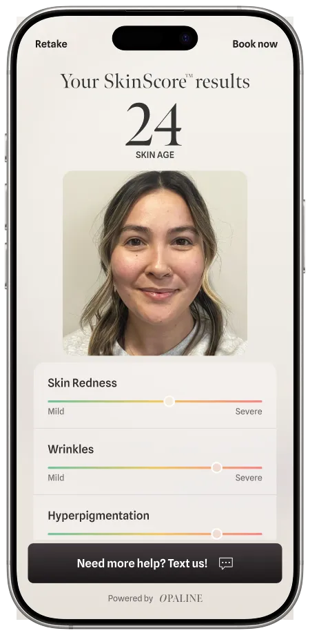 SkinScore Results